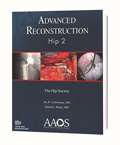 Advanced Reconstruction: Hip 2, AAOS 2018